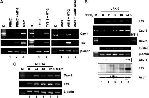 Figure 3. HTLV-1 and Tax induce caveolin-1 expression. (A) Expression of HTLV-1 Tax and caveolin-1 during HTLV-1 infection of normal PBMCs, TY8-3, and A549. Normal PBMCs, TY8-3, and A549 were cocultured with or without MMC-treated MT-2 cells. After cocultivation, cells were harvested, and the expression of the indicated genes was analyzed by RT-PCR. β-Actin mRNA was used as a control. (B) Induction of caveolin-1 by Tax. JPX-9 cells were treated with 20μM CdCl2 for the indicated time periods. RT-PCR was carried out for caveolin-1, caveolin-2, Tax, IL-2Rα, and β-actin (loading control). Western blot analysis was also performed for caveolin-1, Tax, and actin (loading control). (C) RT-PCR analysis for expression of caveolin-1 and Tax in PBMC samples from a patient with ATL (ATL 14) without or with 24 to 72 hours of culture. Representative results of 3 separate experiments with similar findings.