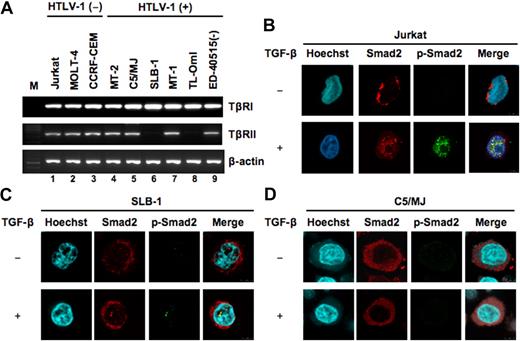 Figure 6. Suppression of TGF-β signaling in HTLV-1–infected T-cell lines. (A) TβRI and TβRII mRNA expression by RT-PCR. Representative results of 3 separate experiments with similar findings. (B-D) Immunofluorescence analysis of Smad2 and phosphorylated Smad2 staining in T-cell lines. The indicated cells were incubated either in the absence or in the presence of TGF-β (10 ng/mL) for 30 minutes and then doubly immunostained with antibodies that specifically recognize Smad2 and phosphorylated Smad2, followed by staining with Alexa Fluor 568–labeled goat anti–mouse IgG (red) and Alexa Fluor 488–labeled goat anti–rabbit IgG (green), and counterstained with Hoechst 33342 (nuclei stained in blue). Localization of the indicated proteins was analyzed by confocal immunofluorescence microscopy.