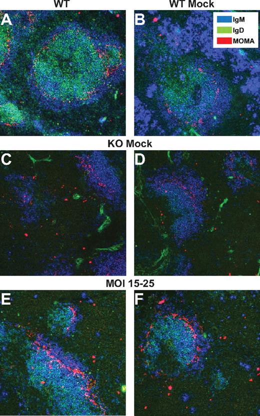 Figure 3. EμB29-Btk-LV therapy restores splenic follicular morphology. Frozen sections from secondary transplantation mice were stained for IgM (blue), IgD (green), and MOMA (red) and then imaged using fluorescence microscopy. Slides were analyzed for the presence of follicles, indicated by IgMloIgDhi follicular B cells (green) separated from IgMhiIgDlo marginal zone B cells (blue) by a ring of MOMA+ marginal zone macrophages (red). Images show representative spleen sections from a WT control mouse (A) and recipients of WT mock (B), KO mock (C-D), and LV MOI 15- to 25-treated BM (E-F).