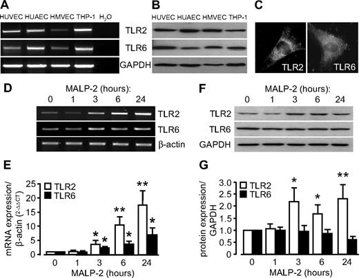 Figure 1. MALP-2 up-regulates TLR2/6 expression in endothelial cells. (A) TLR2 and TLR6 mRNA expression was determined by PCR. Glyceraldehyde-3-phosphate dehydrogenase (GAPDH) expression is shown as loading control. Representative pictures of 3 independent experiments are shown. (B) TLR2 and TLR6 protein expression was demonstrated by Western blot. GAPDH expression is shown as loading control. Representative pictures of 3 independent experiments are shown. Human monocytic THP-1 cells were used as positive control. (C) Immunofluorescent staining of HUVECs with antibodies against TLR2 and TLR6. Representative pictures of 3 independent experiments are shown (Leica DM 4000B microscope, 40×/0.75 NA dry objective, Leica DFC 320 camera, Leica QWin Version 3 software). (D) Products of real-time PCR were run on agarose gels showing TLR2 and TLR6 mRNA levels in HUVECs after MALP-2 (1 μg/mL) stimulation for the indicated time points. β-Actin mRNA expression is shown as loading control. Representative pictures are shown. (E) Quantification of TLR2 and TLR6 mRNA levels relative to β-actin mRNA levels by real-time PCR (n = 10). *P < .05, **P < .01 vs 0 hours. (F) Western blot showing TLR2 and TLR6 protein levels in HUVECs after MALP-2 (1 μg/mL) stimulation for the indicated time points. GAPDH expression is shown as loading control. Representative pictures are shown. (G) Quantification of TLR2 and TLR6 protein levels relative to GAPDH protein levels (n = 4-6). *P < .05, **P < .01 vs 0 hours. (E,G) Error bars represent mean ± SEM.