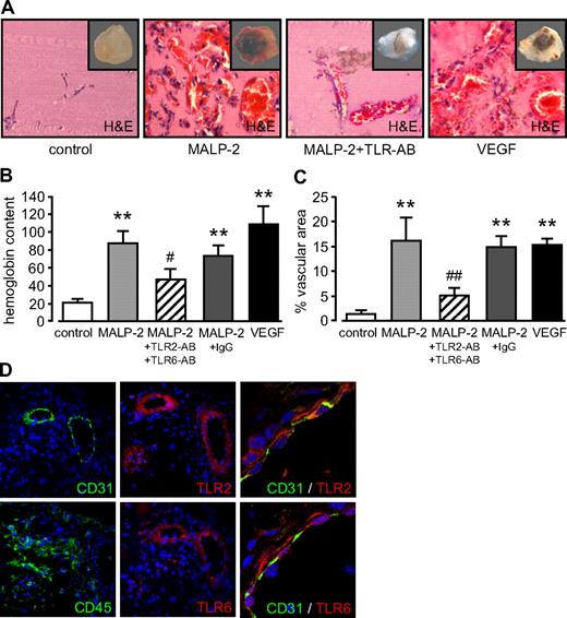 Figure 2. TLR2/6-dependent stimulation by MALP-2 promotes angiogenesis in vivo. (A) Representative pictures of hematoxylin and eosin-stained sections of Matrigel plugs after the administration of MALP-2 (1 μg/mL) for 6 days. VEGF (50 ng/mL) was used as positive control. AB indicates antibody (25 μg/mL each). Insets represent the total Matrigel plug. Vascular structures are filled with erythrocytes. (B) Hemoglobin content is given in micrograms per milligram of Matrigel. (C) Vascular structures are expressed as percentage vascular area per field. Unspecific IgG (50 μg/mL) was used as antibody control (n = 4-8). **P < .01 vs control. #P < .05, ##P < .01 vs MALP-2. (B-C) Error bars represent mean ± SEM. (D) Immunofluorescent staining of Matrigel plaques after the administration of MALP-2 (1 μg/mL) for 6 days with antibodies against CD31, CD45, TLR2, and TLR6. Colocalization of CD31 with TLR2 and TLR6, respectively, was visualized by confocal microscopy (right panels). Representative pictures of 3 independent experiments are shown. Image acquisition: (A and left/middle panels of D) Leica DM 4000B microscope, 20×/0.50 NA dry objective, Leica DFC 320 camera, Leica QWin Version 3 software. (D right panels) Leica DM IRB microscope, 40×/1.25 NA oil objective, Leica immersion oil, TCS SP2 AOBS scanhead, Leica LCS confocal software, Version 1347.