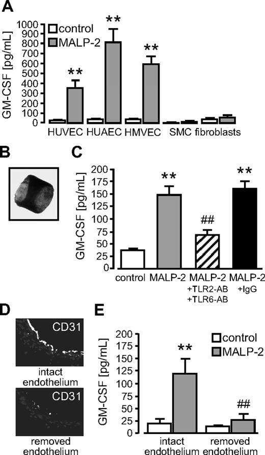 Figure 5. Vascular GM-CSF released by TLR2/6-dependent MALP-2 stimulation occurs exclusively from the endothelium. (A) GM-CSF levels in supernatants of different vascular cells after MALP-2 (1 μg/mL) stimulation for 24 hours determined by ELISA (n = 3-6). SMC indicates smooth muscle cells. **P < .01 vs control. (B) Picture represents a segment of the murine aorta (Zeiss Axiovert 200M microscope, 5×/0.25 NA dry objective, Zeiss AxioCam MRc camera, AxiVision Version 4 software). (C) GM-CSF levels in the supernatants of murine aortic segments after MALP-2 (1 μg/mL) stimulation for 24 hours determined by ELISA. Unspecific IgG (50 μg/mL) was used as antibody control (n = 4-6). AB indicates antibody (25 μg/mL each, ). **P < .01 vs control. ##P < .01 vs MALP-2. (D) Immunofluorescent staining of murine aortic segments with antibodies against CD31. Representative pictures of segments with intact or removed endothelium are shown (Leica DM 4000B microscope, 20×/0.50 NA dry objective, Leica DFC 320 camera, Leica QWin Version 3 software). (E) GM-CSF levels in supernatants of murine aortic segments with intact or removed endothelium after MALP-2 (1 μg/mL) stimulation for 24 hours determined by ELISA (n = 4). **P < .01 vs control. ##P < .01 vs MALP-2. (A,C,E) Error bars represent mean ± SEM.
