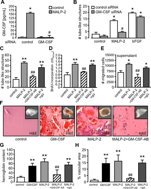 Figure 7. Blockade of GM-CSF inhibits MALP-2-induced angiogenesis. (A) GM-CSF levels in supernatants of HUVECs after siRNA application (10 nM) and MALP-2 (1 μg/mL) stimulation for 24 hours determined by ELISA (n = 3). *P < .05 vs control. #P < .05 vs MALP-2. (B) Quantification of the numbers (#) of tube-like structures of HUVEC after application of siRNA (10 nM) and MALP-2 (1 μg/mL) for 24 hours. bFGF (100 ng/mL) was used as positive control (n = 4). *P < .05 vs control. #P < .05 vs MALP-2 plus control siRNA. (C) Quantification of the number (#) of tube-like structures of HUVEC after application of GM-CSF antibody and MALP-2 (1 μg/mL) for 24 hours. AB indicates antibody (10 μg/mL). Unspecific IgG (10 μg/mL) was used as antibody control (n = 4). **P < .01 vs control. ##P < .05 vs MALP-2. (D) Proliferation of HUVECs was determined by BrdU incorporation after application of GM-CSF antibody and MALP-2 (1 μg/mL) for 16 hours. AB indicates antibody (10 μg/mL). Unspecific IgG (10 μg/mL) was used as antibody control (n = 4). **P < .01 vs control. ##P < .01 vs MALP-2. (E) Migration of HUVEC (1 × 105) was carried out in transwell cell-culture inserts for 24 hours. As chemoattractant, supernatants from unstimulated HUVEC or after 24-hour stimulation with MALP-2 (1 μg/mL) alone or pretreated with GM-CSF antibody were used (n = 4). AB indicates antibody (10 μg/mL). Unspecific IgG (10 μg/mL) was used as antibody control (n = 4). *P < .05 vs control. ##P < .01 vs MALP-2. (F) Representative pictures of hematoxylin and eosin–stained sections of Matrigel plugs 6 days after the administration of GM-CSF (100 ng/mL) and MALP-2 (1 μg/mL). AB indicates antibody (10 μg/mL each). Insets represent the total Matrigel plug. Vascular structures are filled with erythrocytes. Image acquisition: Leica DM 4000B microscope, 20×/0.50 NA dry objective, Leica DFC 320 camera, Leica QWin Version 3 software. (G) Hemoglobin content is given as micrograms per milligram of Matrigel. (H) Vascular structures are expressed as percentage vascular area per field. Unspecific IgG (10 μg/mL) was used as antibody control (n = 4-8). **P < .01 vs control. ##P < .01 vs MALP-2. (A-E,G,H) Error bars represent mean ± SEM.