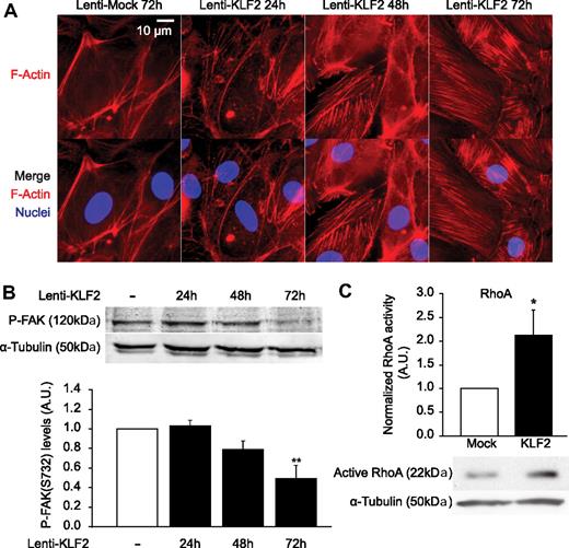 Figure 2. KLF2 induces early cytoskeleton changes, inhibits FAK S732 phosphorylation, and activates RhoA. (A) HUVECs were cultured on glass coated with fibronectin and fixed after 24, 48, or 72 hours of lentiviral overexpression. Nuclei were stained with Hoechst 33342 (blue) and actin filaments with Phalloidin-TRITC (red), and fluorescent microscopy was performed. (B) Western blot analysis of levels of FAK phosphorylated on serine residue 732 in mock- (□) and KLF2-transduced HUVECs (■) at 24, 48, and 72 hours after transduction. α-Tubulin was used as a loading control. (Bottom) Densitometric quantification of the Western blot (n = 4). (C) Active RhoA was isolated with glutathione S-transferase–tagged Rhotekin, and a representative subsequent Western blot for RhoA is shown. Three independent experiments were quantified and corrected for α-tubulin. *P < .05, **P < .01.