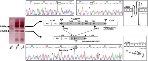 Figure 1. Identification of the ΔCD20 splice isoform mRNA. Agarose gel electrophoresis of full-length (fl) PCR of the CD20 coding sequence from the Daudi and Raji cell line cDNA. Sequencing electrophoregrams of both full-length wt and truncated (ΔCD20) CD20 forms, showing juxtaposed part of the end of exon 3 (Ex) and exon 7. Localization of splicing sites (DS indicates donor site; and AS, acceptor site) on the RNA sequence (Ex1 to Ex8; UTR indicates untranslated regions). Correspondence of CD20 protein segments is shown (TM indicates transmembrane domains), and RTX epitope localization is indicated on wtCD20 as a hatched box. A schematic figure of the intracellular putative ΔCD20 is given for comparison to the wt protein. MW indicates the 100-bp molecular marker. ATG and TAA indicate start and stop codons, respectively.