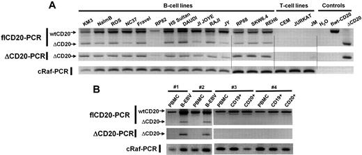 Figure 2. RT-PCR detection of the ΔCD20-spliced mRNA. Qualitative full-length RT-PCR (flCD20-PCR) and specific RT-PCR (ΔCD20-PCR) allowing detection, respectively, of both wt/Δ or specific Δ forms of CD20. cRaf PCR amplified a control gene. flCD20 and ΔCD20 controls consisted of plasmids carrying the respective cloned sequences (A) on different B- and T-cell lines and (B) on in vitro B-EBV–produced cell lines and their respective PBMCs and on CD19+- or CD20+-purified cells from healthy donors and their corresponding PBMCs.