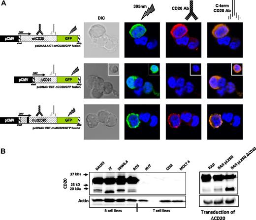 Figure 3. ΔCD20 protein expression. (A) Confocal microscopy analysis of wt and ΔCD20 protein expression, on 293T cells transfected with different constructs carrying flCD20, ΔCD20, or mutCD20 cDNA fused with a GFP sequence leading to the expression of a CD20/GFP fusion protein. Cells were imaged using a Fluoview FV1000 (Olympus) and were stained with DAPI (blue) for nuclear staining and also with either monoclonal anti-CD20 antibody (recognizing wt and mutCD20 forms; red), C-term anti-CD20 antibody (recognizing all CD20 forms; orange), or by GFP 385-nm excitation (green). wtCD20 and mutCD20-transfected cells show membrane staining according to the presence of the 4 transmembrane domains allowing anchoring, whereas ΔCD20/GFP staining is localized mainly within the cytoplasm and absent within the membrane. Simultaneous staining (intracellular and membrane) was achieved with an anti–C-term CD20 antibody. DIC indicates differential interference contrast; and ORF, open reading frame. Untransduced cells were used as controls. (B) Western blot (WB) analysis, after denaturing acrylamide electrophoresis, with anti–C-term CD20 antibody of whole-cell lysates from B- and T-cell lines (left) and a retrovirally transduced Raji cell line with a vector carrying the ΔCD20 cDNA (right). As expected, we detected a signal at position 33 to 35 kDa, corresponding to the wtCD20 protein isoforms (differentially phosphorylated), but also 2 additional bands at 15 to 17 kDa, corresponding to the size of the translated spliced mRNA. The 2 bands at position 15 to 17 kDa could correspond to different phosphorylation states of the ΔCD20 protein. Moreover, detection of an increased signal at the same size length after CD20 transduction confirmed that the smaller band is the product of the ΔCD20 mRNA translation. Antiactin WB on the whole-cell lysates was performed as controls.