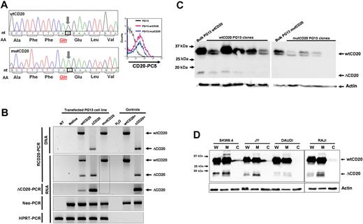Figure 4. ΔCD20 alternative transcripts code for an intracellular ΔCD20 protein. (A) Site-directed mutagenesis was performed on the wtCD20 sequence, using the QuikChange II XL Site-Directed Mutagenesis Kit (Stratagene), according to manufacturer recommendations to kill the AS, with respect to the amino acid sequence. Left panel shows electropherograms after site-directed mutagenesis, confirming that the third nucleotide of the CAG codon (Gln) is replaced by an A nucleotide. Right panel shows cytometry detection of the mutCD20 protein with a monoclonal anti-CD20 antibody at the cell surface of transfected PG13 cells. (B) flCD20- or ΔCD20-PCR on DNA or cDNA of transfected PG13 packaging cell line with wtCD20, ΔCD20, or mutCD20 retroviral plasmids. Neo-PCR was performed to control cell transfection and hypoxanthine-guanine-phosphoribosyl transferase (HPRT)–PCR to confirm the absence of inhibitors of the PCR reactions. flCD20 and ΔCD20 plasmids were used as positive controls. The dashed box highlights the absence of ΔCD20 PCR products, even with the ΔCD20-specific PCR, after transfection of PG13 with the mut-CD20 construct. (C) Western blot analysis with the C-term anti-CD20 on cell lysates from the bulk cell population or isolated cloned PG13 cells transfected with constructs carrying wtCD20 or mutCD20 cDNA sequences. Absence of detection at 15 to 17 kDa confirms that the splice sequence is the source of the ΔCD20 protein expression. (D) Western blot analysis on whole protein lysate (W) or subcellular fractions as cytoplasm (C) and membrane (M) for 4 different B-cell lines using the C-term CD20 antibody.