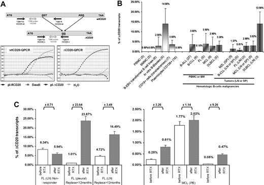Figure 6. Quantification of the spliced ΔCD20 mRNA in activated B cells and hematologic malignancies, and illustration of clinical relevance through 2 cases. (A) Design of the RT-qPCR with schematic localization of primers and bifluorescent FAM/TAMRA TaqMan probe. Both PCRs (ΔCD20- and wtCD20-specific) were performed using an iCycler thermocycler (Bio-Rad) under standard TaqMan PCR conditions with the TaqMan Universal PCR Master Mix (Applied Biosystems). Copy number of both forms of CD20 mRNA was assessed by comparison against serial plasmid dilutions carrying either the flCD20 or the ΔCD20 cloned cDNA. Representative qPCR curves confirming absence of cross-amplification between wtCD20- and ΔCD20-qPCR allowing, respectively, detection of both wtCD20 and ΔCD20mRNA. (B) ΔCD20 mRNA quantification in normal PBMCs or BMMCs from healthy donors as well as in in vitro EBV-transformed B-cell lines, in vitro–generated B blasts, or in CD19+ cell-sorted cells from tonsillectomy samples and CD138+ plasmocytes from multiple myeloma. Quantification of ΔCD20 mRNA, performed in duplicate, in different normal (PBMCs, BMMCs) or hematologic B malignancies or tumor samples from lymph node (LN), spleen (SP), or pleural effusion (PL) was also reported. Number of cases analyzed for each normal or neoplasia cases are given in brackets in the sample's names of the x-axis. (C) RT-qPCR of CD20 transcripts on pre-rituximab (sensitive) and post-rituximab (resistant) primary cells. Left panel shows human samples (LN or PL) of patients (n = 3) with FL and treated with 3 or 4 courses of RTX. Among these 3 representative cases, 1 is a nonresponse to RTX, whereas the other 2 are early (< 12 months) or late (> 12 months) relapses. Right panel shows PB quantification on 3 patients with MCL (n = 3) from a clinical trial of the French GOELAMS group and treated with 4 courses of RTX (375 mg/m2 of RTX). Fold changes (× FC) are indicated. ΔCD20 transcript quantification is reported as relative percentage of ΔCD20: R = (ΔCD20 / wtCD20 + ΔCD20) × 100. Error bars in panels B and C represent SE of RT-qPCR replicates.