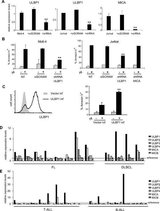 Figure 2. ULBP1 is required for Vγ9Vδ2 T-cell recognition of leukemia/lymphoma cells and displays a highly heterogeneous expression in cancer patients. (A) Lentiviral shRNA-mediated knockdown of ULBP1 and MICA in Molt-4 or Jurkat leukemia cells was confirmed by quantitative RT-PCR using GUSB and PSMB6 as endogenous references. Cells were infected with 10 μL of high-titer virus (107 CFU/mL) in media containing polybrene, submitted to selection 48 hours later, and collected for analysis 96 hours after infection. siSCRAM is an shRNA of scrambled (unspecific) sequence, used as an infection control. Error bars represent SD (n = 3). **P < .01. (B) Molt-4 or Jurkat leukemia cells, subjected to ULBP1 or MICA shRNA knockdown (as in panel A), were used in in vitro killing assays either in the presence (+) or absence (−) of γδ-PBLs (as in Figure 1A). Nontransduced (NT) and siSCRAM-transduced cells were used as controls. (C) Raji lymphoma cells were lentivirally transduced with ULBP1 (or control vector), and surface expression of ULBP1 was assessed by flow cytometry (left). In vitro killing assays were then performed either in the presence (+) or absence (−) of γδ-PBLs (right). (D-E) Quantitative RT-PCR analysis of mRNA expression of NKG2DLs in 8 follicular lymphoma (FL) and 4 diffuse large B-cell lymphoma (DLBCL) biopsies, normalized to housekeeping genes (GUSB and PSMB6) and to a reference sample (reactive follicles) obtained through the same procedure and indicated by the dashed line (D); and in 8 T acute lymphoblastic leukemia (T-ALL) and 7 B acute lymphoblastic leukemia (B-ALL) PBMC samples, normalized to housekeeping genes (GUSB and PSMB6) and to reference PBMCs from healthy persons, indicated by the dashed line (E).