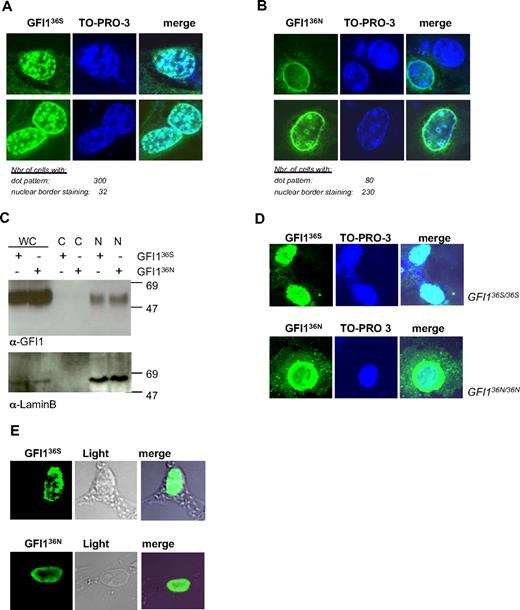 Figure 3. GFI136S and GFI136N proteins show different subnuclear localization. (A) NIH-3T3 cells were transfected with GFI136S expression plasmid. GFI1 appears green; DNA, blue. The right column represents the merging of both staining. The numbers of cells analyzed for GFI136S are indicated. GFI136S is mainly localized in a dotted pattern. (B) NIH-3T3 cells were transfected with a GFI136N expression plasmid. The numbers of cells analyzed for GFI136N are indicated. GFI136N is localized at the nuclear border. (C) NIH-3T3 cells were transfected with either a GFI136S or GFI136N expression plasmid. Cell lysates were fractionated. Both protein variants are localized in the nuclear cell fraction and cannot be found in the cytosolic fraction. (D) Analysis of a bone marrow sample from the only available homozygous for GFI136N. As in transfected cells, GFI136N was mainly located at the nuclear/cytoplasmic border. As a control, cells from the Kasumi 1 t(8;21)-positive AML cell line were used. This cell line was originally derived from a patient with French-American-British M2 AML and is homozygous for GFI136S. (E) Nuclear matrix preparation of NIH-3T3 cells transiently transfected with expression vectors for GFI136S or GFI136N. Both variants are still attached to nuclear matrix components, although the GFI136N variant appears to be more concentrated at the nuclear membrane, consistent with our observation in regular cell transfection assays.