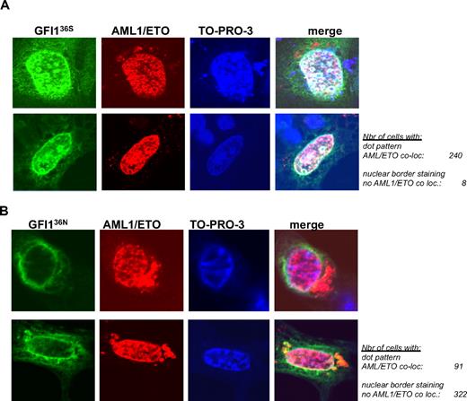 Figure 5. AML1/ETO colocalizes with GFI136S but not with the variant GFI136N. (A) NIH 3T3 cells were transfected with expression vectors for AML1/ETO and GFI136S (original magnification ×100). (B) NIH 3T3 cells were transfected with expression vectors for AML1/ETO and the GFI136N variant form. Expression of GFI1 proteins was revealed by immune-fluorescence with an α-GFI1 antibody and a secondary FITC labeled antibody. The presence of AML1/ETO was revealed by staining with the α-ETO antibody and a secondary rhodamine-labeled antibody. Nuclei were visualized by treatment with the DNA dye TO-PRO-3 (blue). The staining for each protein and DNA is represented in a separate column. Examples of 2 different cells are given for each setting in 2 different rows. The merging of all 3 fluorescence signals is depicted in the last column at the right side and results in a white staining, which can be detected when the signals corresponding to the GFI136S protein and AML1/ETO are merged. White areas or white spots in the nuclei of transfected cells suggest a colocalization of AML1/ETO and the GFI136S protein (A). In contrast, no such white areas can be detected between GFI136N and AML1/ETO (B). The green signal representing the GFI136N protein remained at the nuclear/cytoplasmic border, well separated from the red signal in the nucleus that represents AML1/ETO (B), clearly indicating a lack of colocalization between both. The number of cells analyzed for the subnuclear localization and a colocalization with AML1/ETO are indicated (original magnification ×100).