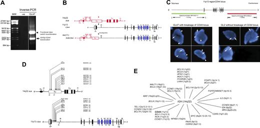 Figure 1. CD44 was identified as a novel translocation partner of IGH in mature B-cell NHLs. (A) Ethidium bromide–stained gel showing the IGHSμ/CD44 translocation product resulting from illegitimate switch recombination (indicated by the arrow) and a self-rearrangement band (indicated by the arrowhead) resulting from the fusion of Sμ to Sγ3 of IGH (functional CSR) in a representative case (gastric GCB-type DLBCL; GL47) with an IGHSμ/CD44 translocation detected by inverse PCR. A vertical white line has been inserted to indicate a repositioned gel lane. (B) Ideogram showing that IGHSμ/CD44 translocations detected in mature B-cell lymphomas result in a classic promoter substitution. The positions and orientations of the primers (SAE/JXE followed by SAI/JXI) used for inverse PCR are indicated. The CD44ΔEx1 mRNA transcripts were activated from derivative 11. The intron/exon map of human CD44 is based on GenBank sequences (accession no. NT009237, DNA; and NM_000610, mRNA).21 Exons 1 to 5 and 15 to 18 (shown as black boxes) are the constitutive exons that code for CD44s (standard from). Exons 6 to 14 correspond to the alternatively spliced variant exons within the extracellular domain (shown as blue boxes). Exon 1 encodes the leader peptide (LP), exon 17 encodes the transmembrane domain (TM), and exon 18 encodes a short cytoplasmic domain. The open arrowhead indicates the coding initiation start site. (C) Interphase FISH confirmed breakage at the CD44 locus in IGHSμ/CD44 translocation-positive cases identified by inverse PCR. Break-apart FISH was performed using 2 BAC clones as probes: clone RP4-607I7 (151 kb) included the 5′ portion of intron 1 of CD44, whereas clone RP4-683L5 (135 kb) was approximately 64.5 kb away from the 3′ end of CD44 (top panel). Representative nuclei from cases with (GL47) or without (GL2) breakage of the CD44 locus are shown, exhibiting one orange, one green, and one yellow (colocalized orange and green) fusion signal pattern (1O1G1F). Vertical and horizontal white lines have been inserted to indicate different nuclei repositioned images. The images were captured by the Leica DMRBE (Leica Microsystem Wetzler GmbH) fluorescence microscope (100×/0.7 NA oil objective). The fluorescent images were imported and created by Cytovision software (Applied Imaging). (D) The IGHSμ/CD44 translocation breakpoints were located within small regions of IGHSμ and at the 5′ end of intron 1 of CD44 in mature B-cell lymphomas. The sequences shown are from GenBank (IGHSμ accession no. NG_001019.3; CD44: accession no. AL356215.11).21 The relative position of the 2 sets of seminested PCR primers used to confirm IGHSμ/CD44 translocations by direct PCR is shown. (E) Chromosomal locations of all IGH translocation partners (annotated genes only) reported in B-cell lymphomas. The CD44 gene (shown in bold) located at 11p13 was identified in this study as the first cell adhesion molecule22 involved in IGH chromosomal translocations in B-cell lymphomas. GL indicates gastric lymphoma; ENL, nongastric extranodal lymphoma; and NL, nodal DLBCL. *Gastric mucosa-associated lymphoid tissue (MALT) lymphoma. **Gastric composite DLBCL with residual MALT lymphoma (DLCLML).