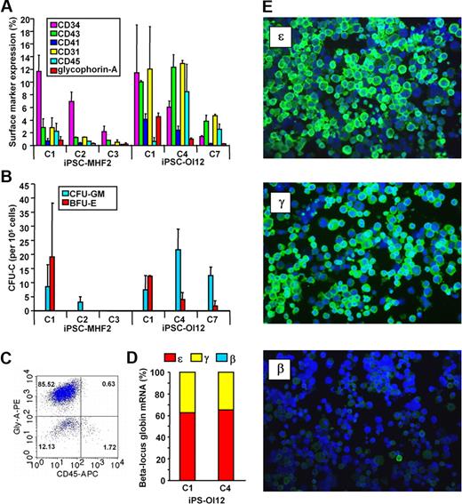 Figure 1. iPSC-derived cells' hematopoietic surface marker expression, clonogenic potential, and globin expression pattern. (A) Hematopoietic surface marker expression by iPSC-derived cells. iPSCs were induced to undergo hematopoietic differentiation by embryoid body (EB) formation as previously described.10 Briefly, undifferentiated iPSC colonies were harvested off the murine embryonic fibroblast feeders and plated onto ultra-low attachment plates (Corning) in the EB medium supplemented with 0.3% methylcellulose (BD Biosciences) for 14 days. At the end of the EB culture, EBs were transferred to Matrigel-coated tissue culture plates (BD Biosciences) and cultured in the hematopoietic growth and expansion medium supplemented with a combination of growth factors. The adherent cells were harvested after 7 days and single-cell suspensions were prepared by enzymatic treatment (0.05% dispase + 0.05% collagenase IA) followed by repeated pipetting. Surface markers were stained using monoclonal antibodies and analyzed using FACSCalibur. Heterogeneity in the response to directed hematopoietic differentiation regimen by individual iPSC lines is shown. Similar results were obtained during spontaneous EB differentiation (data not shown). (B) Clonogenic potential of iPSC-derived cells. Cells prepared as described were cultured either in complete human methycellulose medium (StemCell Technologies) for colony-forming units–granulocyte macrophages (CFU-GM) or in a serum-free semisolid medium10 for burst-forming unit erythroid (BFU-E). The frequency of hematopoietic colonies was enumerated after 14 days of culture. The clonogenic potential differed from line to line. (C) Erythroid differentiation of iPSC. EBs from iPSCs were dissociated by enzymatic treatment followed by forcing through 20G and then 18G needles. Single-cell suspensions were cultured in serum-free media supplemented with erythroid growth factors as previously described.10 Fresh media were added as needed to maintain cell density at ∼ 0.5 × 106/mL through the 14- to 18-day culture period. Robust erythroid development was observed from iPSC-MHF2-C1, iPSC-OI12-C1, or iPSC-OI12-C4. A representative flow cytometric scatter plot of iPSC-OI12-C4–derived cells is shown. Similar to erythroid cells from hESCs,10 iPSC-derived immature and mature erythroid cells do not express CD45. (D) β-Locus globin mRNA expression by iPSC-derived erythroid cells. mRNA was prepared from iPSC-derived erythroid cells and the mRNA levels of all β-like genes were measured by quantitative real-time polymerase chain reaction. High levels of ϵ and γ globin mRNA were detected. (E) Immunostaining of iPSC-derived erythroid cells. Smears prepared from the erythroid cells following serum free liquid culture were stained with monoclonal antibodies against ϵ, γ, or β/δ globin chains, followed by a fluorescein isothiocyanate–conjugated anti-mouse antibody and counterstained with DAPI. Pictures were taken under a Leica DMLB microscope with a 40× PL Fluotar objective using a RT Slider Spot camera. The majority of the erythroid cells expressed ϵ and γ globins, and very few β-producing cells were observed.