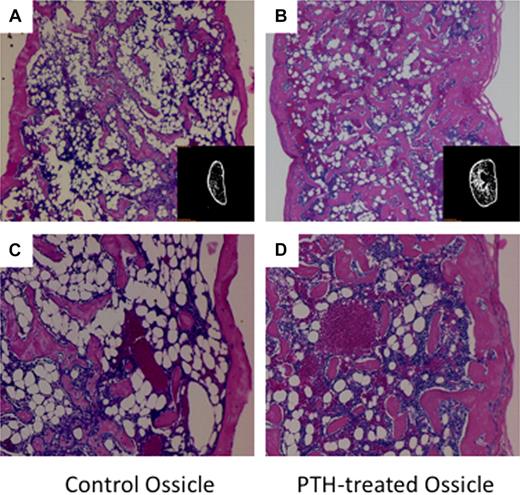 Figure 1. Low- and high-magnification images of H&E-stained ossicle sections and micro-CT images (inset image). PTH-treated ossicles contained a higher density of trabecular bone and bone marrow cells. (A) Ossicle in control group without PTH treatment (×40). (B) Ossicle in PTH-treated group (×40). (C) Ossicle in control group (×100). (D) Ossicle in PTH-treated group (×100).