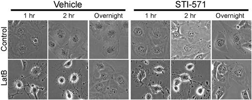 Figure 5. STI-571 does not alter the change in cell shape induced by LatB. HBMECs were seeded on VN blocked with HD-BSA and preincubated (2 hours) with STI-571 (5μM). LatB (0.5μM) or vehicle was added for the duration indicated, and cells were photographed (original magnification ×400).