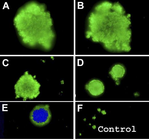 Figure 3. Detection of circulating MKs or their fragments by immunofluorescence labeling of blood smears from VWD2B using a MoAb specific for the αIIbβ3 complex. (A-E) Results for P2 with the R1306W VWD2B mutation show enlarged platelets confirming size diversity with occasional MK staining both with DAPI and for αIIbβ3. Control platelets are shown for comparison (F).