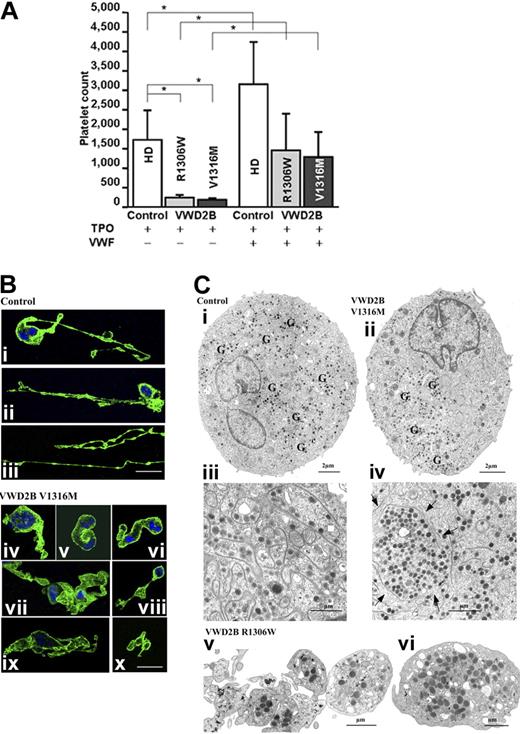 Figure 6. Platelet production and megakaryocytopoiesis in culture. (A) Platelet production from cultured CD34+ MKs obtained from 3 different HDs (empty histograms) used as controls and from 3 patients with VWD2B: 1 patient with mutation R1306W (light gray histograms) and 2 patients with mutation V1316M (dark gray histograms). Relative number of platelets at day 7 of treatment with TPO (left) or TPO and VWF (right). The number of platelets was calculated by flow cytometry on a CD41+/calcein am+-labeled population analyzed in combination with a known number of calibration beads. Data from 2 independent experiments (means ± SD; *P < .05 HD versus each mutant VWF as well as HD and each mutant VWF exposed to VWF versus TPO treatment only). The statistical analyses according to Bonferroni test were grouped as follows. In Group 1, all samples were calculated against TPO-treated HDs. In this group, the TPO-treated VWD2B samples show statistical significance; endogenous VWD2B inhibits platelet production. In Group 2, samples from VWD2B were calculated against TPO-treated VWD2B. In this group, samples treated with normal exogenous VWF are significantly different compared with TPO treatment; normal exogenous VWF normalizes platelet production from VWD2B CD34+ cells. (B) Morphologic studies of the formation of proplatelets as seen by confocal microscopy of MK cultures labeled with an anti-αIIbβ3 (green) antibody and by DAPI (blue). In panels Bi and Bii, the progressive disruption of MK cytoplasm and formation of proplatelets can be seen; MKs appeared with long pseudopods decorated with small blisters corresponding to proplatelets. In panel Biii, the very long pseudopods have a bead-like appearance. For the VWD2B MKs, instead of thin pseudopods, the cytoplasm forms thick protusions (Biv-ix) with interwoven membranes (vii, ix). In panel Bx, 3 distinct but adjacent proplatelets are to be seen. (C) Examination of culture MKs from controls and patients by EM. On the left side (Ci,Ciii), we illustrate the morphology of control MKs, and in panels Cii and Civ, the morphology of VWD2B V1316M MKs. (Ci) Homogeneous presence of granules and DMS. (Cii) All the granules (G) are concentrated in one part of the MK cytoplasm; most of the DMS is also seen in this same area, suggesting a defect in the process of partitioning the components. (Ciii) Shown at a higher magnification is the cytoplasm of another control mature MK, where small platelet territories are well delimited by abundant and well-organized DMS. (Civ) Shown at a high magnification is part of a mature VWD2B MK where an abnormal large platelet territory (arrows) surrounded by DMS can be seen. Globally abnormal distribution of DMS suggests a defect in the organization of membranes during maturation. (Cv-vi) Newly produced platelets from the R1306W MK. (Cv) the platelets are heterogeneous in size, not separated/or agglutinated, and the distribution of granules is heterogeneous. (Cvi) Illustration of a giant platelet as found in the circulation.