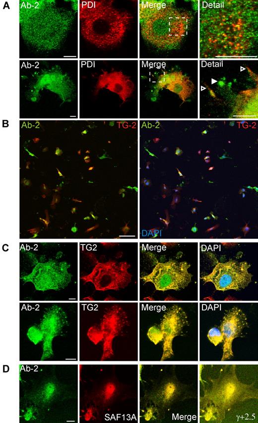 Figure 4. Association of FXIII-A with TG2 but not protein disulphide isomerase in podosomes. Adherent PMA-differentiated THP-1 cells were treated for 6 days with IL-4 (20 ng/mL) and, after fixation and permeabilization, were probed with antibodies to FXIII-A, to protein disulphide isomerase (PDI), and to TG2. (A) Cytoplasmic full-length FXIII-A does not correspond in distribution to PDI (top row). PDI is excluded from podosomes that show a strong signal for Ab-2 (bottom row, filled arrowhead) but is present on other membrane processes (open arrowhead). (B) Cells were imaged with the use of a low-power objective to detect FXIII-A (green) and TG2 (red) fluorescence over the full depth of the cell. Left panel shows an overlay of red and green fluorescence, whereas right panel shows a triple overlay with DAPI fluorescence. A high proportion of cells preferentially expressed one or other transglutaminase, but some cells coexpressed FXIII-A and TG2. Both enzymes were present in the cytoplasm, whereas FXIII-A, but not TG2, was also present in the nucleus. Scale bars represent 100 μm. (C) In cells that coexpressed FXIII-A and TG2, both antigens colocalized in podosomes. (D) Immunofluorescence for Ab-2 (green) corresponded with immunofluorescence detected with a sheep polyclonal anti–FXIII-A antibody. Cell margins are apparent in an image with enhanced γ correction (γ, +2.5).