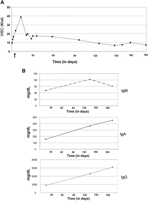 Figure 1. Case report. (A) White blood cell (WBC) counts were performed by The Ohio State University Clinical Laboratory using Beckman Coulter LH. WBC count is expressed over time as absolute numbers in thousands of cells per microliter (K/μL). (B) IgM, IgA, and IgG production was detected by The Ohio State University Clinical Laboratory using the immunoturbidimetric method (Synchron LX System). Values are expressed as milligrams per deciliter.
