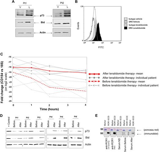 Figure 6. Lenalidomide promotes CD154 gene therapy phenotype. (A) Whole-cell extracts from 48-hour–treated CLL B cells were analyzed by immunoblot for p73 and BID. Actin was used as internal loading control. (B) Representative histograms show expression of DR5 measured by flow cytometry in CLL B cells cultured without (filled gray) or with (filled black) lenalidomide. The gray- and black-lined open histograms correspond to CLL B cells cultured, respectively, with vehicle or lenalidomide and stained with an isotype monoclonal antibody of irrelevant specificity. (C) Peripheral blood mononuclear cells from before and day 8 of therapy were cultured in the presence of ActD and 107 cells were collected over a 4-hour time course as in Figure 3B (n = 5, P < .05). (D) Whole-cell extracts from patients' peripheral blood mononuclear cells before the dose and on day 8 were analyzed by immunoblot for p73 and BID (representative findings in 6 of 9 patients). (E) Purified recombinant human-ROR1 was run in each lane of an SDS-PAGE gel and then transferred to nitrocellulose membrane. Ponceau red staining was performed to assess both purity and equal loading. The membrane was cut into pieces and probed with rabbit anti–human ROR1 (Cell Signaling), goat anti–human ROR1 (R&D), healthy donor serum (ND), or serum from the index case immediately before lenalidomide (before) and on month 6 of therapy (after). The pieces were incubated with HRP-conjugated anti–rabbit, anti–goat, or anti–human IgG.