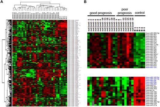 Figure 1. Cluster analysis of MCLs and normal lymphocytes. (A) Tree was generated by the hierarchical cluster analysis showing the separation of normal lymphocytes from MCLs on the basis of all human miRNAs spotted on the chip. (B) A subset of miRNAs, labeled in blue, express differently between poor and good prognostic subgroups.
