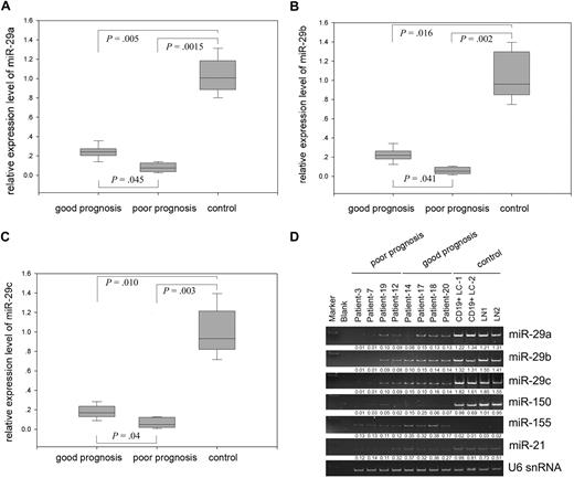 Figure 2. Differential expression of miR-29 family between normal lymphocytes and good and poor prognostic MCLs. Quantitative RT-PCR analysis of miR-29a (A), miR-29b (B), and miR-29c (C) in MCLs and normal lymphocytes. Error bars represent SD. (D) Expression of miR-29 family members miR-150 and miR-155 in representative samples. CD19+ peripheral blood lymphocyte (CD19+ LC) and normal lymph node (LN) were used as controls.