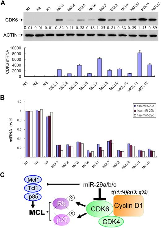 Figure 7. CDK6 is frequently elevated in MCLs, which is inversely correlated with miR-29 expression. Representative MCL specimens express higher levels of CDK6 (A) but lower levels of miR-29 (B) than normal lymphocytes. (C) Schematic illustration of the miR-29 in pathogenesis of MCL.