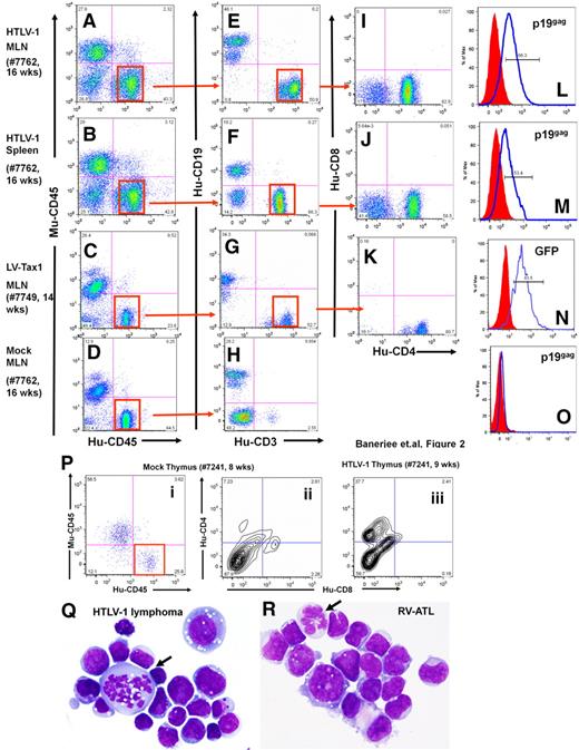 Figure 2. Phenotype analysis of lymphomas from HTLV-1-HU-NOD/SCID and Tax1-HU-NOD/SCID mice. Phenotype analysis of lymphocytes from the MLN (A,E,I,L) and the spleen (B,F,J,M) of HTLV-1-HU-NOD/SCID mouse (#7762, 16 weeks after injection) and MLN of Tax1-HU-NOD/SCID (#7749, 14 weeks after injection) mouse (C,G,K,N). Human CD3+ cells are gated and analyzed in panels I, J, and K. CD4+/CD8− are the predominant populations in HTLV-1-HU-NOD/SCID mice MLN (I) and spleen (J) and Tax1-HU-NOD/SCID mice MLN (K). Human lymphocytes in the mesenteric lymph nodes (D) of mock-infected donor-tissue matched HU-NOD/SCID (#7762, 16 weeks after injection) mice are predominantly of CD19+ (B-cell) lineage (H). HTLV-1 p19gag expression in CD4+ T cells from the MLN (L) and spleen (M) of the HTLV-1-HU-NOD/SCID mouse. Expression of GFP in the CD4+ T cells from (N) the MLN of the Tax1-HU-NOD/SCID mouse and (O) in cells from the MLN of mock-infected mouse. (P) Proliferation of CD4+/CD8− subpopulation among gated human lymphocytes in the thymus of the HTLV-1-HU-NOD/SCID mouse (#7241, 9 weeks after injection; iii) in comparison with mock HU-NOD/SCID mouse (#7241, 8 weeks after injection; ii). Comparative Giemsa staining of lymphoma cells derived from HTLV-1-HU-NOD/SCID mouse (Q) and RV-ATL tumor cell line (R).28