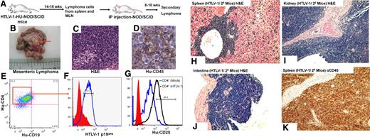 Figure 6. Serial transplantation and engraftment of lymphomas cells from HTLV-1-HU-NOD/SCID mice. (A) Pooled cells from the spleen and MLNs of HTLV-1-HU-NOD/SCID mouse (#7749) were serially transplanted intraperitoneally into naive NOD/SCID mice. Cells from lymphomas in the mesenteric lymph nodes (B), in the secondary recipient mice (#7749-2) as visualized by H&E (C), and immunohistochemistry staining for human CD45 (Hu-CD45; D). Phenotypic analysis of lymphoma cells in the MLN of secondary recipients demonstrate CD4+ staining (E), coexpression of HTLV-1 gag antigen p19gag (F), and expression of CD25 (G). H&E staining demonstrating diffuse large-scale lymphomas in the spleen (H), kidney (I), and small intestine (J) of secondary recipient NOD/SCID mice. (K) Immunohistochemical analysis for human CD45 in the spleen of secondary recipient mice that developed lymphoma.