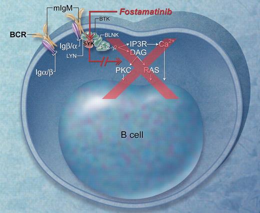 Pathways activated through the BCR that are amplified by Syk and lead to the survival of malignant B cells can be inhibited by fostamatinib. Professional illustration by A. Y. Chen.