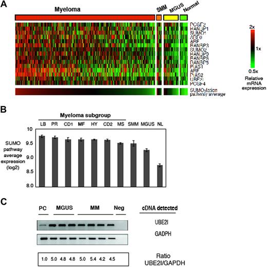 Figure 2. Gene expression profiling of normal, MGUS, smoldering, and myeloma patient plasma cells and generation of a sumoylation pathway signature. (A) Gene expression profiles of sumoylation pathway components from normal, MGUS, SMM (GEO dataset GSE5900), and MM (GEO dataset GSE4204). Samples were median centered and ordered according to average expression of the sumoylation pathway genes. B indicates normal B cells; PC, normal plasma cells; and PCL, plasma cell leukemia. (B) Sumo-pathway signature in the 7 sub-branches of MM, SMM, MGUS, and normal PCs. The sub-branches were classified by expression of MMSET (MS), MAF/MAFB (MF), and proliferation (PR) signatures that constituted high-risk disease, whereas hyperdiploidy (HY), low bone disease (LB), and CCND1/CCND3 translocations (CD1 and CD2) represented low-risk MM. (C) RT-PCR of UBE2I in MGUS and MM patient samples. GAPDH (glyceraldehyde phosphate dehydrogenase) served as a loading control. UBE2I refers to the gene that encodes the SUMO-conjugating enzyme UBE2I; Neg, PCR reaction with no plasma cell cDNA and primers added. Normal plasma cells were purchased from AllCells.