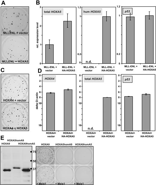 Figure 3. Absence of HOXA5 tumor suppressor properties in hematopoietic cells. (A) Typical example of a replating assay with cells transduced with MLLENL and HOXA5 or empty vector as control. (B) Relative levels of total HOXA5 (ie, murine and transduced human HOXA5), human HOXA5, and p53 mRNAs in cells explanted from a replating assay as shown in panel A. (C) Typical example of a replating assay performed with cells cotransduced with HOXA4 and HOXA5 or control vector as indicated. (D) Transcript levels of HOXA4, HOXA5 (total HOXA5), as well as of p53 were determined by qRT-PCR in cells transduced either with HOXA4/HOXA5 or HOXA4/vector as control. To allow a direct comparison of HOXA4 and HOXA5 expression levels, the scale is given in absolute units relative to β-actin (as ΔCt vs β-actin). (E) Homeobox-swap experiments. (Left) HA-specific immunoblot of swap-constructs exchanging the homeobox motif of HOXA5 against the homeobox of HOXA9 (HOXA5homA9) or vice versa (HOXA9homA5). Normal HOXA9 is shown for comparison. (Right) Typical result of a colony-forming assay in which swap-mutants are used.