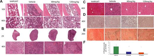 Figure 3. H+E staining of bone marrow, spleen, and liver, and reticulin of hMPLWT mice and hMPLW515L mice treated with vehicle or INCB16562 for 12 days. Hematoxylin and eosin (H+E) stains demonstrate reduced cellularity in the (A) bone marrow and (B) reduced myeloproliferation in the spleen of INCB16562-treated W515L mice. Enumeration of megakaryocytes per ×20 field in 5 fields from the spleens of 2 to 3 mice killed on day 12 after beginning treatment reveals significant dose-dependent decrease in number of megakaryocytes with 60 mg/kg and 120 mg/kg INCB16562 (F). (C) Liver histology reveals greatly reduced extramedullary hematopoeisis in the liver with INCB16562 treatment at either 60 mg/kg or 120 mg/kg W515L mice. Reticulin staining of marrow (D) and spleen (E) reveals a decrease in myelofibrosis with 12 days of INCB16562 treatment. *P < .05 compared with vehicle-treated mice. hMPLWT mice on the other hand, show normal bone marrow (A left panel) and splenic (B left panel) architecture with minimal fibrosis (D-E left panels), and a normal hepatic structure (D left panel). (F) Error bars denote SD.