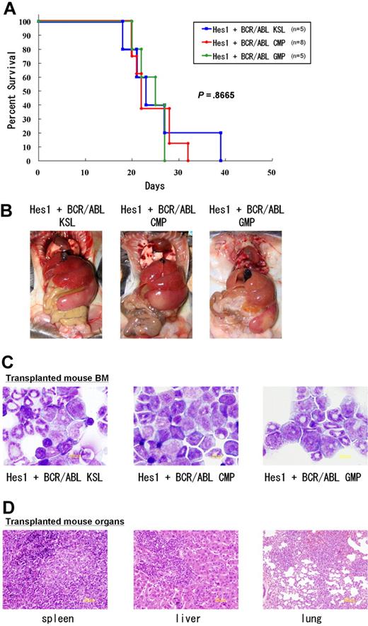 Figure 4. CMPs and GMPs transduced with the combination of Hes1 and BCR-ABL rapidly induced AML/blast crisis of CML. (A) Survival curves of mice. KSLs (n = 5), CMPs (n = 8), and GMPs (n = 5) transduced with the combination of Hes1 and BCR-ABL developed fatal AML/CML in blast crisis-like disease within 18 to 39 days, 20 to 32 days, and 20 to 27 days, respectively. Numbers of injected cells ranged 17 × 102 to 2.6 × 104 for KSLs, 5.5 × 104 to 15 × 104 for CMPs, and 4.0 × 104 to 13.8 × 104 for GMPs. There was no significant difference in latency of penetrance (P < .867). Statistical differences were determined using the log-rank test. Three independent experiments were performed, and the total numbers of transplanted mice are shown. (B) Tissue distribution of the leukemic cells. Mice transplanted with KSLs, CMPs, and GMPs transduced with the combination of Hes1 and BCR-ABL invariably demonstrated marked hepatosplenomegaly and lung hemorrhage, both resulting from infiltration of leukemic cells. (C) The morphology of bone marrow cells from representative recipient mice. Increased myeloid blasts were seen with no significant difference among KSLs, CMPs, and GMPs. (D) Histology of spleen, liver, and lungs from representative mice receiving Hes1+BCR-ABL+ GMPs. Vast infiltration of leukemic cells is seen. There were no differences in the histology among mice receiving Hes1+BCR-ABL+ KSLs, CMPs, and GMPs.