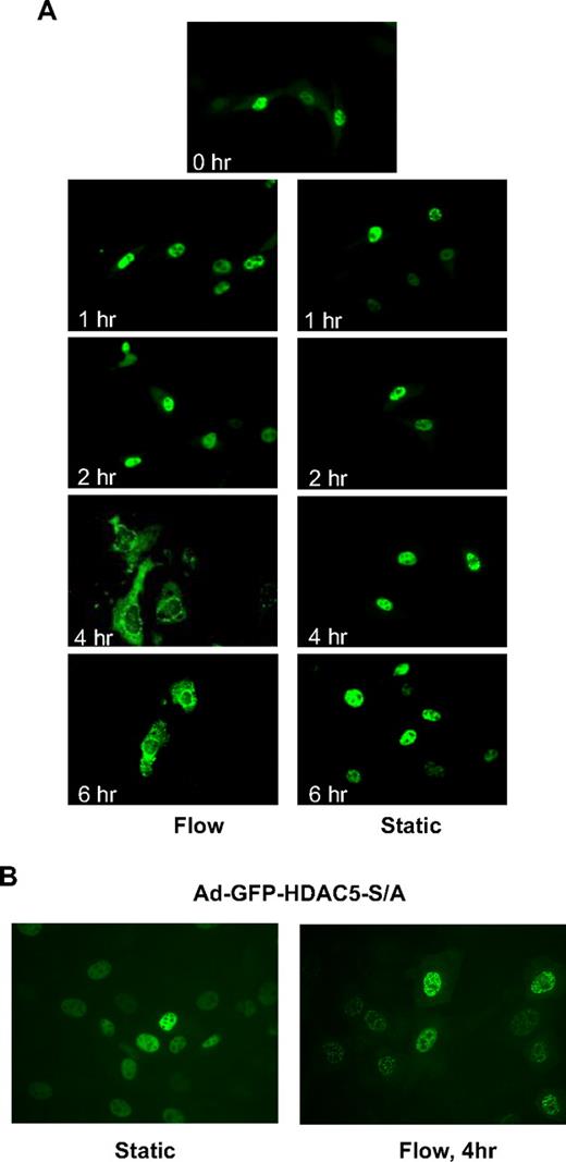 Figure 2. Fluid shear stress induced phosphorylation-dependent HDAC5 nuclear export. (A-B) HUVECs were infected with Ad-GFP-HDAC5 or Ad-GFP-HDAC5-S/A. Twenty-four hours later, cells were conditioned with flow (left lane) or static (right lane) for the time indicated in each image. Images were captured at a magnification of ×60, using a fluorescence microscope.