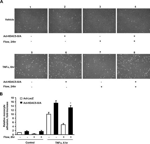 Figure 6. HDAC5-dependent pathway modulated flow anti-inflammation in endothelial cells. (A-B) Overexpression of Ad-HDAC5-S/A attenuated flow anti-inflammation. HUVECs were infected with Ad-HDAC5-S/A or Ad-LacZ as control. Twenty-four hours later, cells were subjected to flow or to static conditions for 24 hours followed by the treatment of TNFα or vehicle for 6 hours. U937 monocytes were added to HUVECs and incubated for 30 minutes. HUVECs were washed 3 times. The adherent monocytes were counted in 5 randomly optical fields in each dish. *P < .05, flow + TNFα + Ad-HDAC5-S/A vs flow + TNFα + Ad-LacZ. Error bars represent ±SEM.
