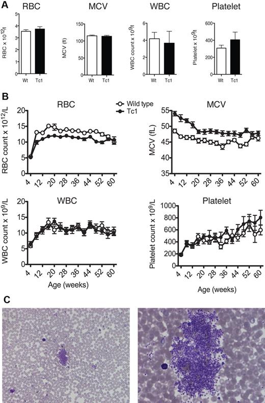Figure 1. Tc1 mice present with macrocytic anemia throughout life. (A) Graphs of mean (± SEM) red blood cell (RBC), white blood cell (WBC), and platelet counts and mean corpuscular volume (MCV) of neonate (< 1 day old) Tc1 and wild-type (Wt) mice (n = 6). (B) Graphs show mean (± SEM) RBC, WBC, and platelet counts and MCV as a function of age of Tc1 and wild-type mice (n = 15). Tc1 mice show decreased RBC counts from 8 to 52 weeks of age and increased MCV from 4 to 52 weeks of age (P < .05). (C) Low-power (left) and high-power (right) views of Wright-Giemsa–stained blood smears from Tc1 mice aged 64 weeks showing clouds of platelets.