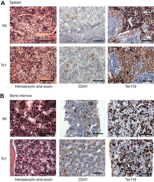 Figure 3. Increased megakaryopoiesis in Tc1 mice older than 15 months. (A) Photomicrographs of sections of spleens from a Tc1 mouse with an enlarged spleen and a wild-type (Wt) control mouse, both aged 15 months. Sections were stained with hematoxylin and eosin, or with antibodies to CD41 or Ter119. The enlarged Tc1 spleen shows an increased number of megakaryocytes seen both in the hematoxylin and eosin and anti-CD41 stains. (B) Bone marrow sections from Wt and Tc1 mice stained as in panel A. Scale bars in panels A and B indicate 100 μm.