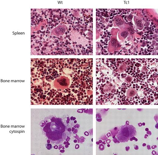 Figure 4. Megakaryocytes in Tc1 mice are less mature. Photomicrographs of sections of spleen and bone marrow stained with hematoxylin and eosin and cytospins of bone marrow cells stained with May-Grünwald and Giemsa stains, from Wt and Tc1 mice aged 15 months.