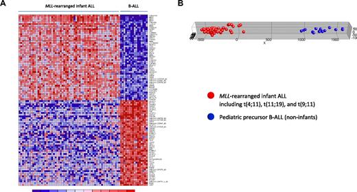 Figure 2. MLL-rearranged infant ALL versus pediatric precursor B-ALL (HU133plus2.0). (A) Heatmap showing the separation of MLL-rearranged infant ALL (n = 59) from pediatric precursor B-ALL (n = 16) samples based on the 100 probe sets most significantly discriminative between both patient groups as attained in our analyses using HU133plus2.0 GeneChips. Columns represent patient samples, and rows represent the gene names corresponding to the probe sets. Normalized gene expression is depicted in red (high expression) or blue (low expression). The top 50 probe sets are relatively overexpressed and the bottom 50 probe sets relatively underexpressed in MLL-rearranged infant ALL (which include t(4;11) (n = 29), t(11;19) (n = 22), and t(9;11)-positive (n = 8) cases). (B) Graphic representation of PCA based on this gene expression signature, separating the MLL-rearranged infant ALL (red dots) from pediatric precursor B-ALL (blue dots) samples.