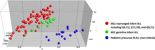 Figure 3. Unsupervised clustering analysis of MLL-rearranged infant ALL, MLL germline infant ALL, and pediatric precursor B-ALL. Completely unsupervised clustering analysis (PCA) of MLL-rearranged infant ALL (n = 59; red dots), MLL germline (wild-type MLL) infant ALL (n = 14; green dots), and pediatric precursor B-ALL (n = 16; blue dots) samples, using all 54 675 probe sets present on the HU133plus2.0 GeneChip.
