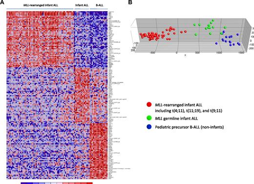 Figure 4. Supervised clustering analysis of MLL-rearranged infant ALL, MLL germline infant ALL, and pediatric precursor B-ALL. (A) Heatmap visualizing differential gene expression separating MLL germline infant ALL (n = 14), from MLL-rearranged infant ALL (n = 59) and pediatric precursor B-ALL (n = 16) samples, based on the 50 most significantly up-regulated probe sets for each patient group (compared with the other patient groups combined). Columns represent patient samples, and rows represent the gene names corresponding to the probe sets. Normalized gene expression is depicted in red (high expression) or blue (low expression). (B) Graphical representation of the supervised clustering of the samples based on this expression signature. Red dots indicate MLL-rearranged infant ALL; green dots, MLL germline infant ALL; and blue dots, the pediatric precursor B-ALL samples.