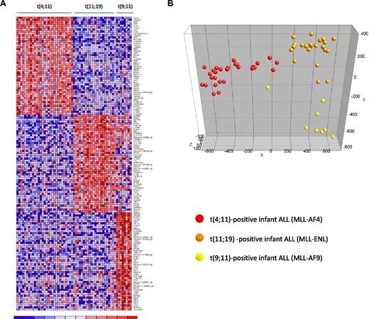 Figure 5. Gene expression–based separation of MLL-rearranged infant ALL subtypes. (A) Heatmap demonstrating differential gene expression between t(4;11) (n = 29), t(11;19) (n = 22), and t(9;11)-positive (n = 8) MLL-rearranged infant ALL samples, based on the 50 most significantly up-regulated probe sets for each patient group (compared with the other patient groups combined). Columns represent patient samples, and rows represent the gene names corresponding to the probe sets. Normalized gene expression is depicted in red (high expression) or blue (low expression). (B) PCA plot clustering the t(4;11) (red dots), t(11;19) (orange dots), and t(9;11) (yellow dots) according to these 150 selected probe sets.
