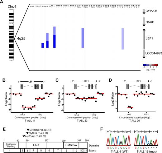 Figure 1. LEF1 microdeletions and truncating mutations are recurrent genetic alterations in T-ALL. Array CGH was performed on genomic DNA from diagnostic specimens collected from 47 children with T-ALL. (A) dChip plot of the segmented CGH log2 copy number ratios at the LEF1 genomic locus. Recurrent microdeletions involving LEF1 and no other known genes were identified in 5 (11%) of the 47 primary T-ALL samples. Note that cases 36 and 37 were excluded because CGH quality controls failed. (B-D) Raw CGH log2 copy number ratio data (black dots) shown for 3 representative cases, together with the genomic location of LEF1 exons. The segmented data plotted in panel A are shown as red lines. The y-axis is log2 of the copy number ratio (0 = no copy number change). (E) Sequencing of LEF1 genomic coding sequence identified heterozygous nonsynonymous sequence alterations in 3 (7%) of the 44 T-ALL cases analyzed. Black arrowheads denote the location of predicted truncating mutations, whereas the white arrowhead denotes the missense mutation identified. (F) Sequence chromatograms for representative mutant and wild-type samples, showing the presence of a heterozygous frameshift mutation in sample T-ALL 13.