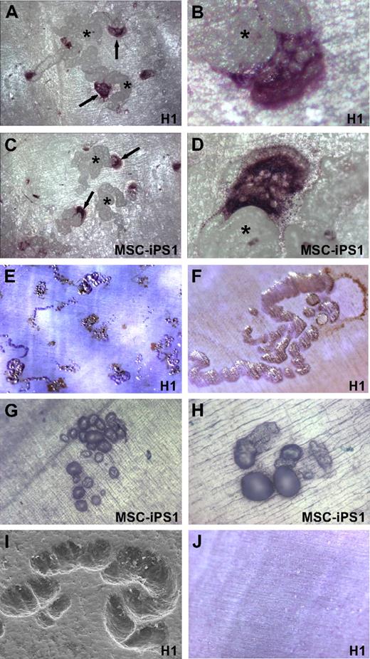 Figure 4. Differentiation of functional osteoclasts from hESC and hiPSCs. Representative micrographs of multinucleated osteoclasts derived from H1-derived (A-B) and MSC-iPS1–derived (C-D) hematopoietic precursors. Cells from day 20 cultures were seeded onto dentine slices in the presence of M-CSF and RANKL, and osteoclasts were stained 2 weeks later for TRAP activity (↑). Clear multinucleation is evident (B,D) and prominent resorption trails (*) are associated with all osteoclasts as viewed under reflected light. Resorption lacunae created by H1-derived (E,F,I) and MSC-iPS1–derived (G-H) osteoclasts were identified after removal of cells and staining with toluidine blue or by scanning electron microscopy (I). Cells cultured in the absence of RANKL did not differentiate into TRAP-positive cells, and resorption pits were never observed (J). Images were acquired with a Leica MZ FLIII stereomicroscope using a DFC300 FX camera. Auto adjustments were performed with Adobe Photoshop software. Original magnifications: ×4 (E); ×10 (A,C,G,J); ×20 (F,H); and ×40 (B,D).