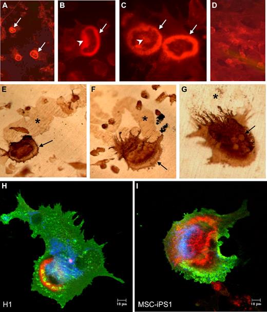Figure 6. Expression of mature osteoclast markers. Mature osteoclasts derived from hESCs express F-actin rings (A-C) and VNR (E-G). H1-derived hematopoietic precursors from day 21 cultures were seeded at 105 cells/96-mm well onto dentine slices in the presence of M-CSF and RANKL and stained 14 days later with TRITC-phalloidin (A-C) or by immunohistochemistry for VNR with the 23C6 antibody (E-G). F-actin rings (white arrows, panels A-C), ruffled borders (white arrowheads, panels B-C), and strong VNR expression (black arrows, panels E-G) are present in actively resorbing, multinucleated osteoclasts. Resorption trails are clearly visible in panels E-G (*). Images were acquired with a Zeiss Axioskop2 Plus microscope equipped with epifluorescence using plan-Neofluar objectives and an Axiocam camera. Auto adjustments were performed with Adobe Photoshop software. Laser confocal microscopy demonstrates the coexpression of β3 integrin (green), F-actin rings (red), and cathepsin K (blue) in H1-dervied (H) and MSC-iPS1–derived (I) osteoclasts. F-actin ring–positive cells were never detected in cultures lacking RANKL (D). Original magnifications: ×10 (A,D); ×20 (B,C,E,F); and ×40 (G).
