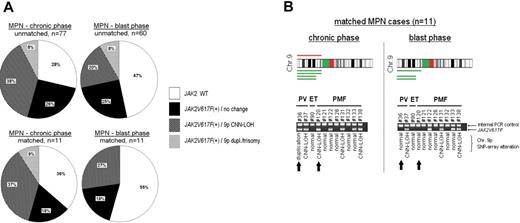 Figure 1. Frequency of JAK2V617F and associated alterations on chromosome 9. (A) Diagrams represent matched and unmatched MPN cases in chronic versus blast phase. Indicated are frequencies of JAK2V617F and association to 9p duplication (dupl)/trisomy 9 or 9pCNN-LOH. Data and statistical evaluation for underlying MPN subgroups are shown in supplemental Table 3. (B) CNAG software represents duplication (red) and CNN-LOH (green) on 9p detected in 11 patients with matched samples (chronic MPN vs MPN-blast phase). In addition, allele-specific PCR for the detection of JAK2V617F was performed in these samples. Arrows indicate 2 MPN patients who were initially positive for JAK2V617F in association with 9p imbalances; leukemic transformation was accompanied with loss of JAK2V617F and a normal chromosome 9.