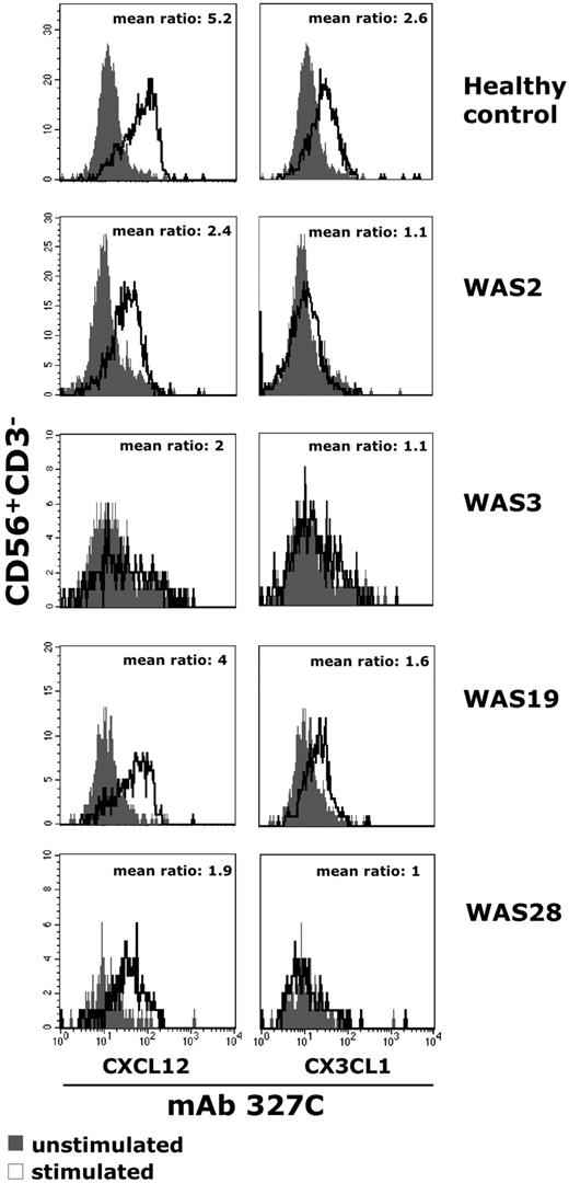 Figure 6. The ability of chemokine to induce LFA-1 high-affinity state is impaired in NK cells from patients with WAS. Freshly isolated peripheral blood NK cells from healthy donors or patients with WAS were left untreated or stimulated with CXCL12/SDF-1 (10nM) or CX3CL1/fractalkine (1nM) and simultaneously stained with the high-affinity reporter mAb 327C for 10 minutes at 37°C. Cells were then analyzed by flow cytometry. The ratio between the mean fluorescence intensity of stimulated (open profile) versus unstimulated (black profile) cells is shown. The results shown for healthy control are representative of 6 individual experiments.