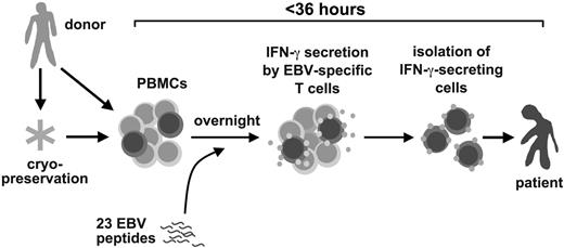 Figure 1. A rapid method to prepare Epstein-Barr virus–specific T cells for adoptive T-cell therapy for posttransplant lymphoproliferative disease.